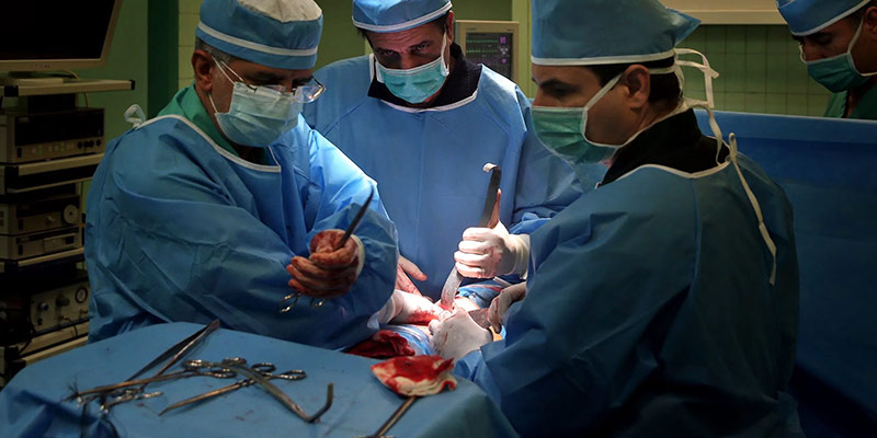 Kidney Transplant Doctor